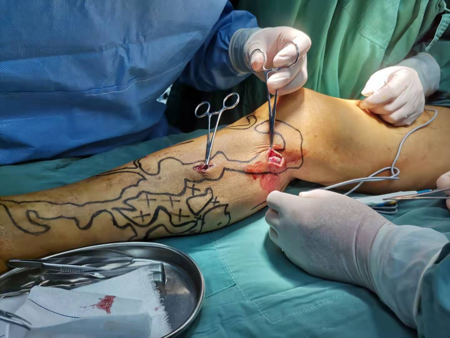 绑腿游戏怎么玩_玩法绑腿游戏叫什么_绑腿游戏玩法