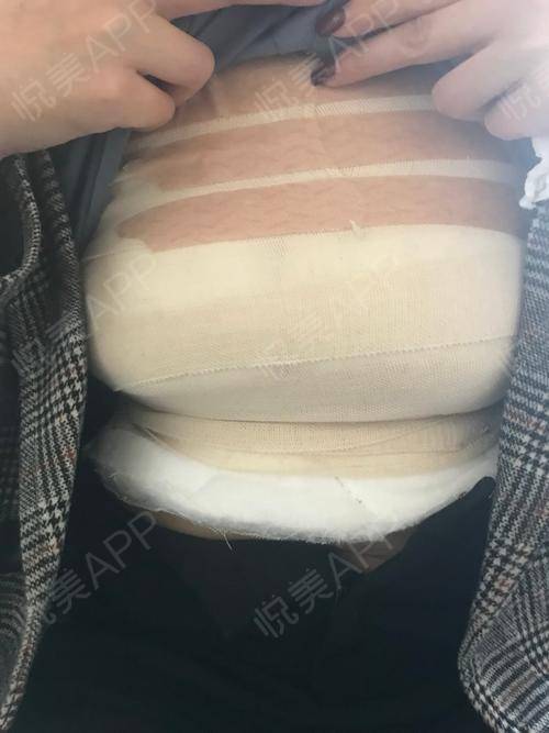 乳房美容整形外科手术学_上海外科脚步整形医院地址_整形再造外科杂志