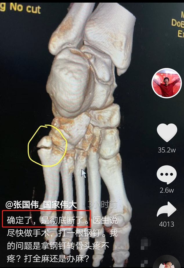 游戏惩罚小游戏_游戏惩罚小程序_MC游戏惩罚小游戏手机